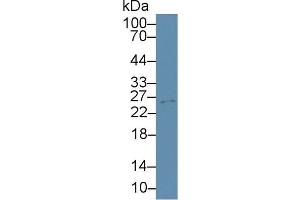 Western Blot; Sample: Mouse Cerebrum lysate; ;Primary Ab: 3µg/ml Rabbit Anti-Mouse TIMP4 Antibody;Second Ab: 0.