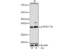 Western blot analysis of extracts of C6 cells, using Phospho-RP-T21 Rabbit mAb (ABIN7269916) at 1:1000 dilution. (RPA2 anticorps  (pThr21))