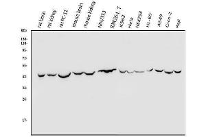 Western blot analysis of TXNIP using anti-TXNIP antibody (ABIN7601882).