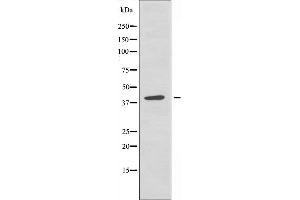 Western blot analysis of extracts from A549 cells, using TISD antibody. (ZFP36L2 anticorps  (Internal Region))