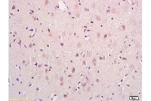 Formalin-fixed and paraffin embedded mouse kidney tissue labeled with Anti PRODH Polyclonal Antibody,Unconjugated (ABIN715136) at 1:200 followed by conjugation to the secondary antibody and DAB staining.