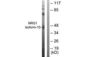 Western blot analysis of extracts from SKOV3 cells, using NRG1 isoform-10 antibody. (Neuregulin 1 anticorps  (Isoform 10))