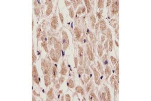 (ABIN6242180 and ABIN6577907) staining ADORA2A in Human heart tissue sections by Immunohistochemistry (IHC-P - paraformaldehyde-fixed, paraffin-embedded sections).
