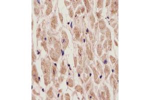 (ABIN6242180 and ABIN6577907) staining ADORA2A in Human heart tissue sections by Immunohistochemistry (IHC-P - paraformaldehyde-fixed, paraffin-embedded sections). (Adenosine A2a Receptor anticorps  (C-Term))