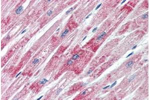 Human Heart (formalin-fixed, paraffin-embedded) stained with DBP antibody ABIN462166 followed by biotinylated goat anti-rabbit IgG secondary antibody ABIN481713, alkaline phosphatase-streptavidin and chromogen.