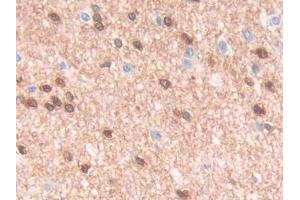 DAB staining on IHC-P; Samples: Human Cerebrum Tissue (QDPR anticorps  (AA 1-244))