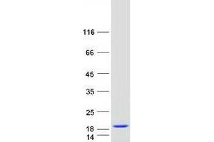 Validation with Western Blot