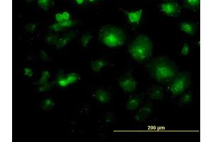 Immunofluorescence of monoclonal antibody to LFNG on HeLa cell. (LFNG anticorps  (AA 1-250))