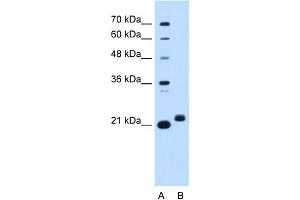 WB Suggested Anti-C1orf159 Antibody Titration:  0. (C1orf159 anticorps  (Middle Region))