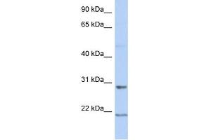 WB Suggested Anti-C12orf53 Antibody Titration: 0. (C12orf53 anticorps  (Middle Region))