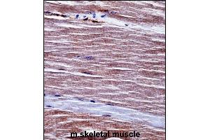 Mouse Acvr1 Antibody (Center) ((ABIN657718 and ABIN2846706))immunohistochemistry analysis in formalin fixed and paraffin embedded mouse skeletal muscle followed by peroxidase conjugation of the secondary antibody and DAB staining.