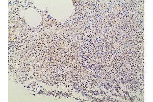 ABIN6277691 at 1/100 staining rat appendiceal tissue sections by IHC-P. (Ephrin B2 anticorps  (C-Term))