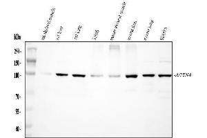 Western blot analysis of Alpha Actinin 4 using anti-Alpha Actinin 4 antibody (ABIN4886421). (alpha Actinin 4 anticorps  (AA 561-661))