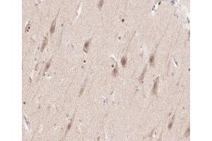 ABIN6266540 at 1/100 staining human brain tissue sections by IHC-P.