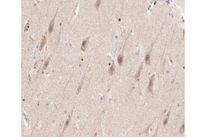 ABIN6266540 at 1/100 staining human brain tissue sections by IHC-P. (FGFR3 anticorps  (C-Term))