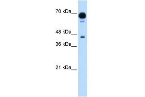 WB Suggested Anti-PUS7 Antibody Titration:  1. (PUS7 anticorps  (N-Term))