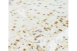Immunohistochemistry of paraffin-embedded Human stomach using EFTUD2 Polyclonal Antibody at dilution of 1:100 (40x lens).