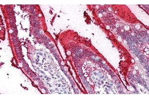 Detection of SI in Human Small Intestine Tissue using Polyclonal Antibody to Sucrase Isomaltase (SI)