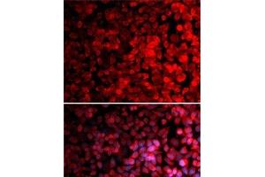 Immunofluorescence analysis of MCF7 cells using RPS10 Polyclonal Antibody (RPS10 anticorps)