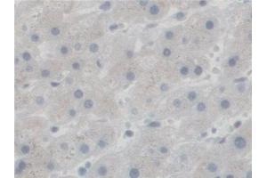 Detection of SGSH in Human Liver Tissue using Polyclonal Antibody to N-Sulfoglucosamine Sulfohydrolase (SGSH)