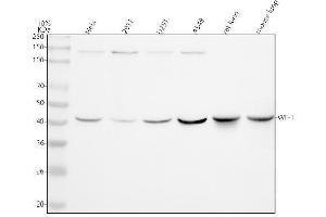 Western blot analysis of WIF1 using anti-WIF1 antibody (ABIN7606713).