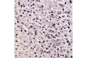 Immunohistochemistry of paraffin-embedded mouse pancreas using Phospho--S473+-S474+-S472 Rabbit pAb (ABIN7265523) at dilution of 1:100 (40x lens). (AKT 1/2/3 anticorps  (pSer472))
