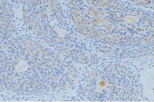 ABIN6268899 at 1/100 staining Human uterus tissue by IHC-P. (Gastrin anticorps  (C-Term))