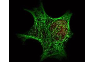 Immunofluorescence Microscopy of Rabbit Anti-HDAC-1 antibody.