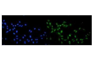 IF analysis of KAT13A/SRC1 using anti-KAT13A/SRC1 antibody (ABIN3042385). (NCOA1 anticorps  (AA 614-826))