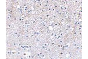 Immunohistochemical staining of human brain tissue using GRIK5 polyclonal antibody  at 2. (GRIK5 anticorps  (C-Term))