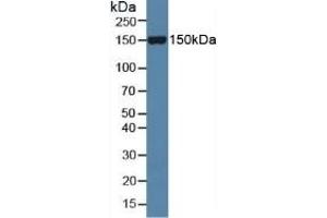 Detection of Slit1 in Mouse Serum using Polyclonal Antibody to Slit Homolog 1 (Slit1)