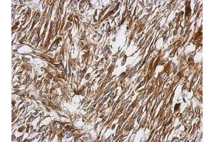 Image no. 3 for anti-Protein Kinase C, theta (PRKCQ) (AA 15-294) antibody (ABIN1501904)