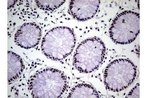 Image no. 18 for anti-Nibrin (NBN) (AA 183-460) antibody (ABIN1491066)