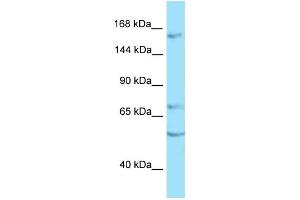 WB Suggested Anti-PTPRT Antibody Titration: 1.