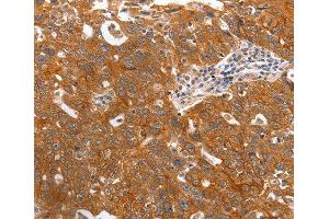 Immunohistochemistry (IHC) image for anti-Pepsinogen C (PGC) (AA 100-200) antibody (ABIN3016695)