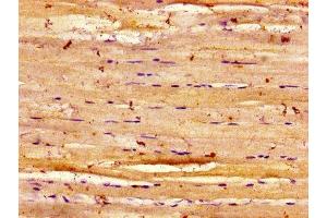 Immunohistochemistry of paraffin-embedded human skeletal muscle tissue using ABIN7150914 at dilution of 1:100 (Dysferlin anticorps  (AA 105-278))