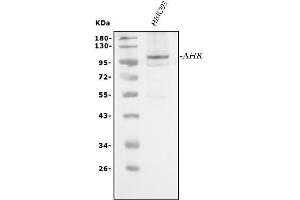 Western blot analysis of AHR using anti-AHR antibody (ABIN6719265).