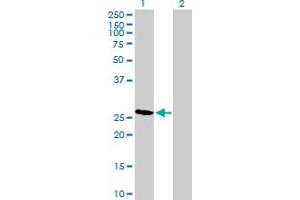Western Blot analysis of RCAN2 expression in transfected 293T cell line by RCAN2 MaxPab polyclonal antibody. (RCAN2 anticorps  (AA 1-225))