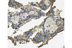 IHC analysis of FIS1 using anti-FIS1 antibody (ABIN7598965). (Fission 1 anticorps  (AA 1-121))