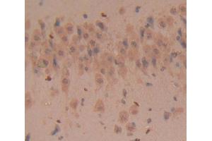 Used in DAB staining on fromalin fixed paraffin- embedded Kidney tissue