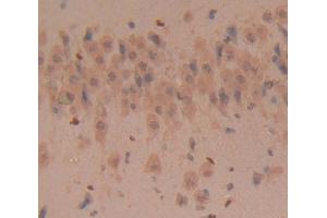 Used in DAB staining on fromalin fixed paraffin- embedded Kidney tissue (CD160 anticorps  (AA 33-171))