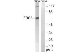 Western blot analysis of extracts from HepG2 cells, using FRS2 (Ab-196) antibody. (FRS2 anticorps  (Tyr196))
