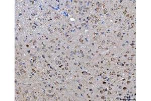 IHC analysis of ch TOG/CKAP5 using anti-ch TOG/CKAP5 antibody (ABIN6719294). (CKAP5 anticorps  (AA 1-221))