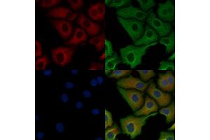 ABIN6263603 and ABIN6278495 staining Hela cells by IF/ICC. (Netrin 1 anticorps  (C-Term))