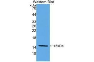 Detection of Recombinant KLb, Human using Monoclonal Antibody to Klotho Beta (KLb) (Klotho beta anticorps  (AA 517-636))