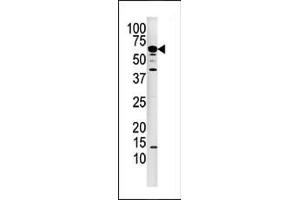 Western blot analysis of anti-P3CA Pab (ABIN392891 and ABIN2842291) in mouse kidney tissue lysate.