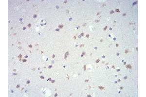 Immunohistochemical analysis of paraffin-embedded brain tissues using IL28A mouse mAb with DAB staining.