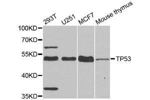 Western blot analysis of extracts of various cell lines, using TP53 antibody.