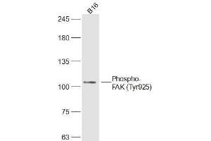 B16 lysates probed with Phospho-FAK (Tyr925) Polyclonal Antibody, Unconjugated  at 1:300 dilution and 4˚C overnight incubation. (FAK anticorps  (pTyr925))