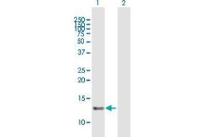 Western Blot analysis of SNRNP25 expression in transfected 293T cell line by SNRNP25 MaxPab polyclonal antibody. (SNRNP25 anticorps  (AA 1-132))